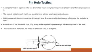 Pinhole Occluder Use in Visual Acuity Testing .